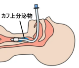カフ上分泌物.png