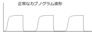 正常なカプノ.png